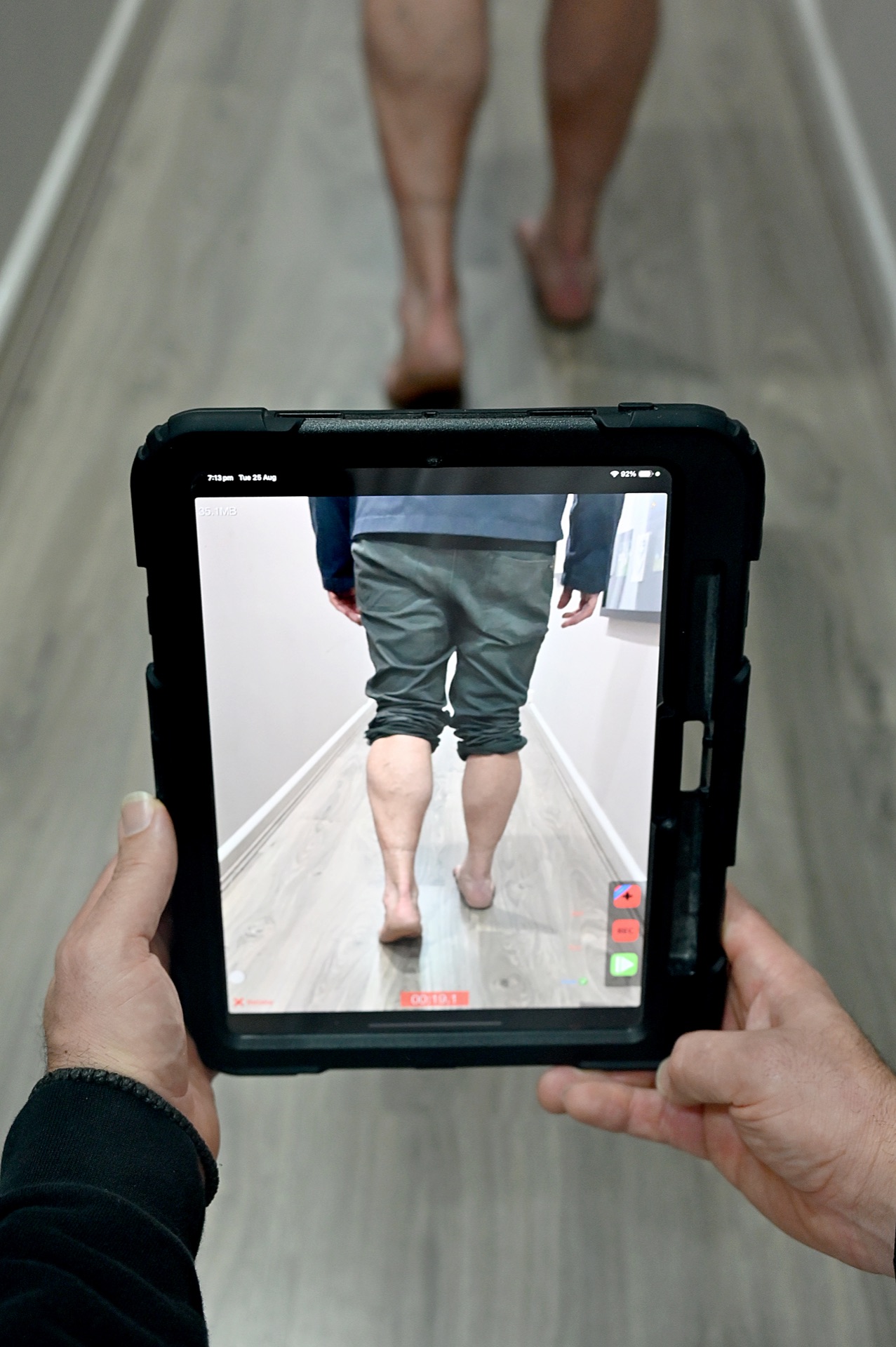 Gait and movement assessment at Coburg Podiatry